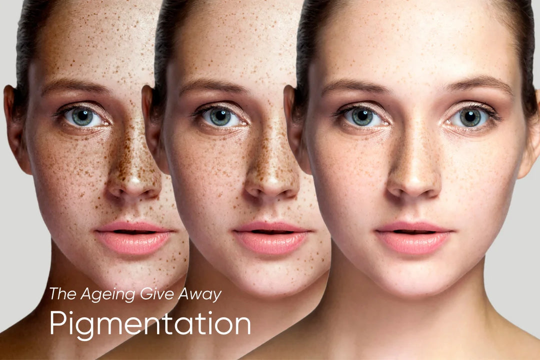 Pigmentation - The Ageing Giveaway!