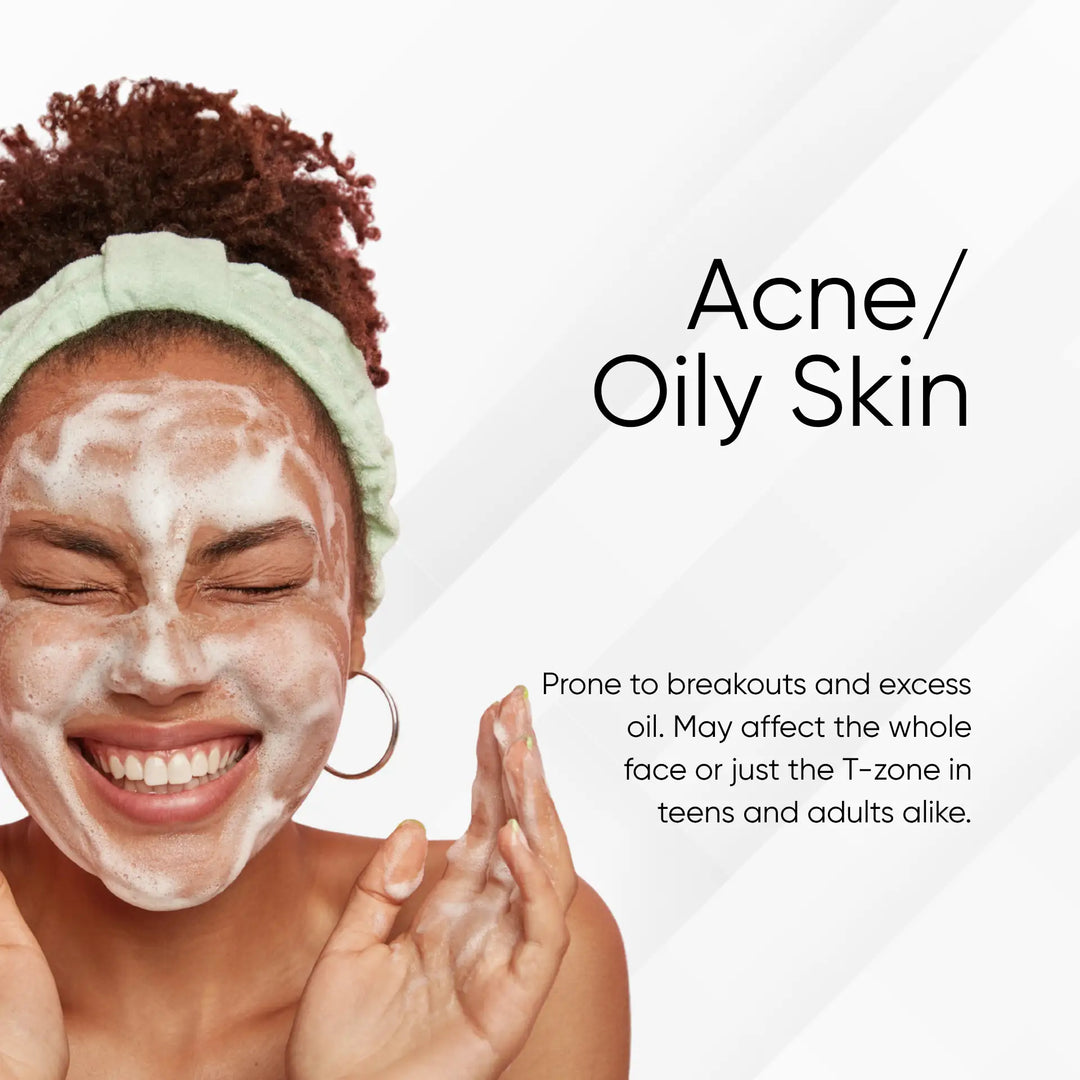 Oily Acne Prone
