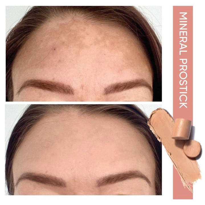 Before and after comparison using ISSADA Mineral Prostick.
