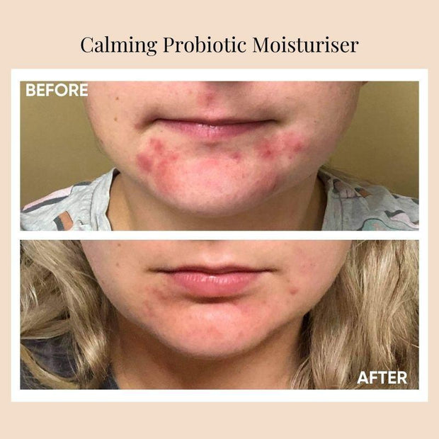 Calming Probiotic Moisturiser - Issada Mineral Cosmetics & Clinical Skincare
